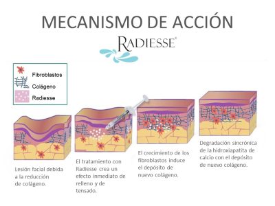 mecanismo de acción radiesse